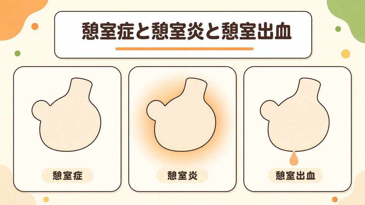 大腸憩室症と大腸憩室炎と大腸憩室出血は何が違う？