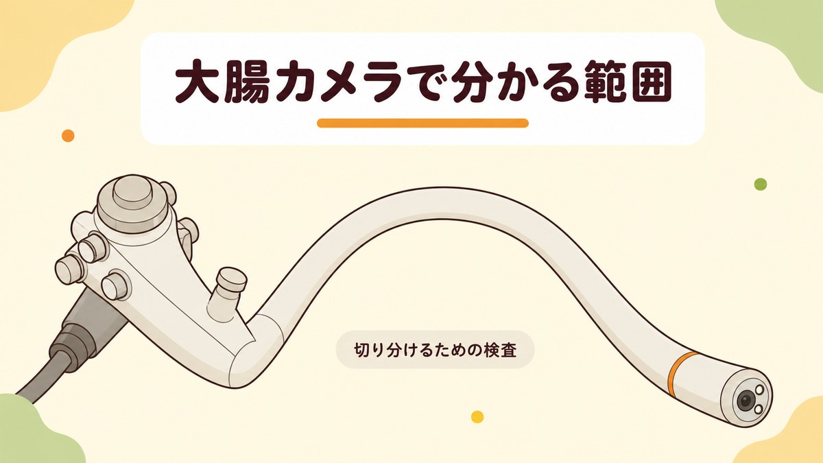 下痢が続く原因を大腸カメラ(大腸内視鏡検査)で切り分けられる範囲