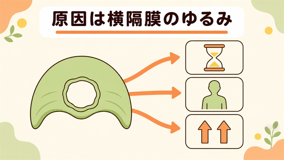 食道裂孔ヘルニアの原因とされる横隔膜の靭帯のゆるみ