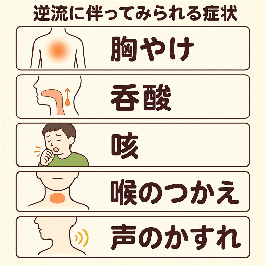 逆流に伴ってみられる症状(胸やけ・呑酸・咳・喉のつかえ・声のかすれ)