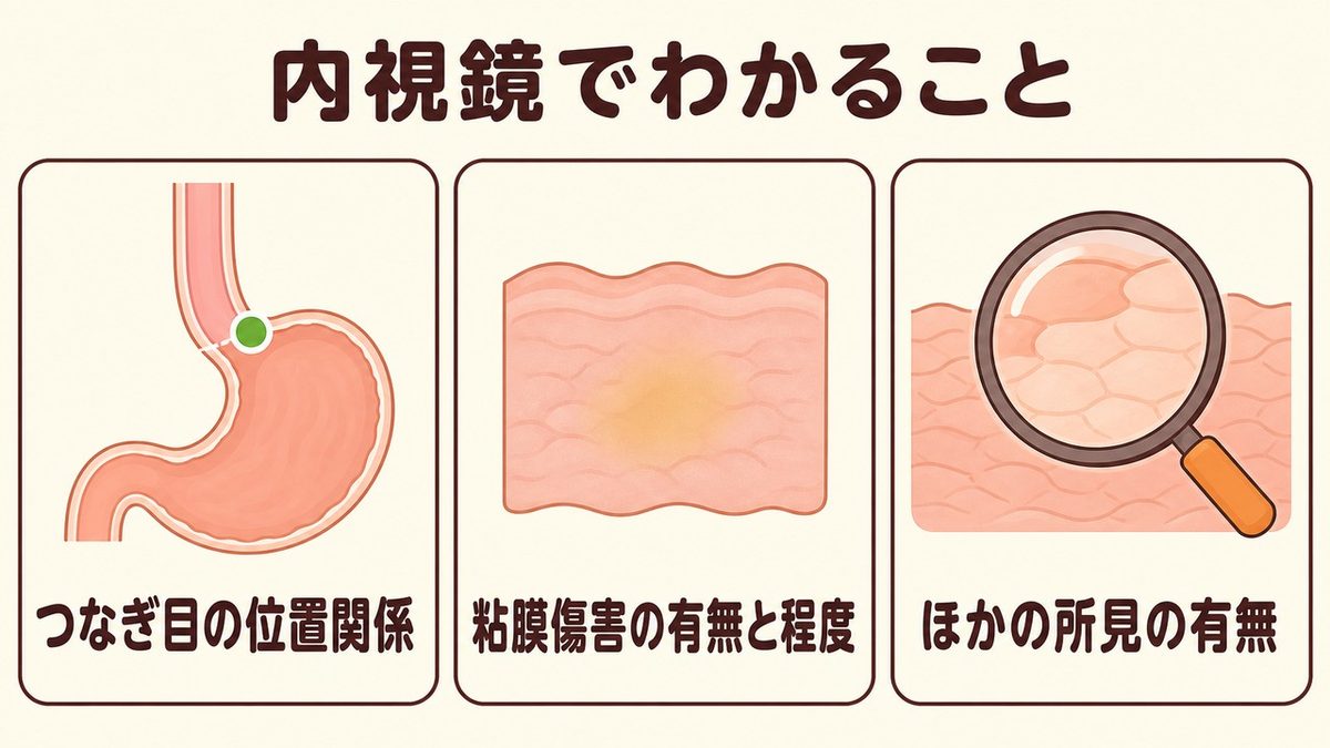 内視鏡でわかる3点