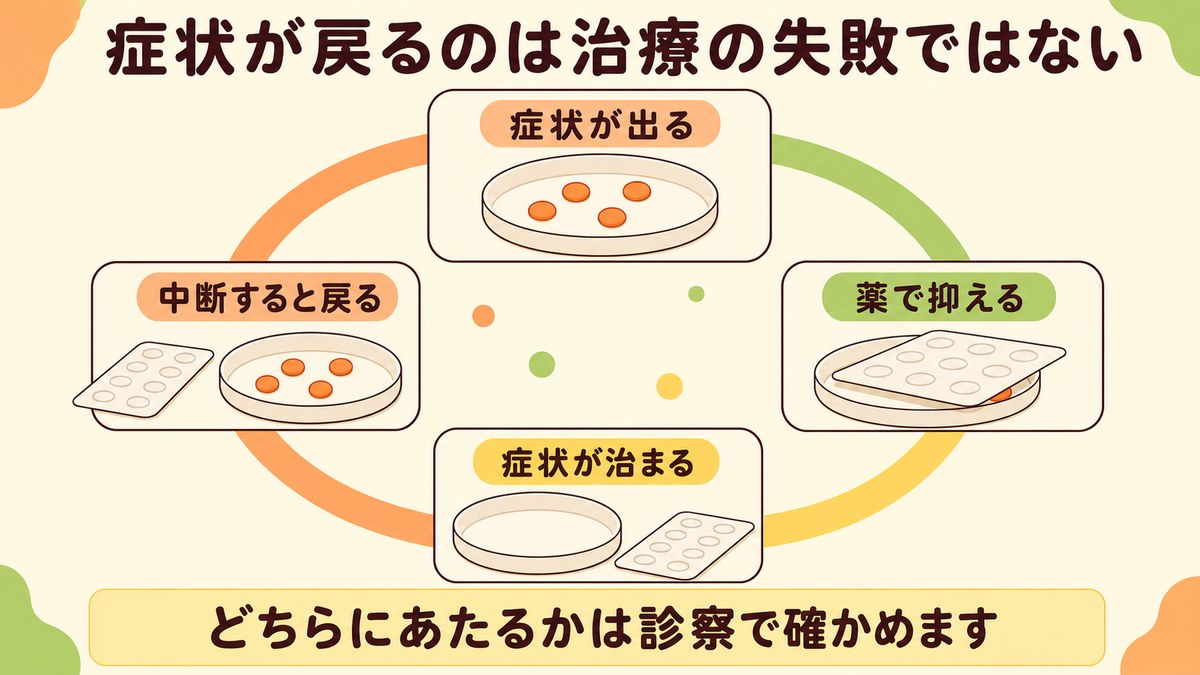 症状が出る、薬で抑える、症状が治まる、中断すると戻るという流れが一周する図。症状が戻ることが治療の失敗とは限らないことを示している