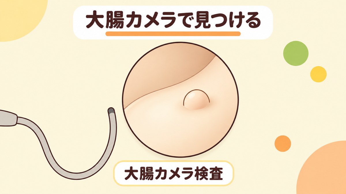 大腸ポリープはどうやって見つかるのか