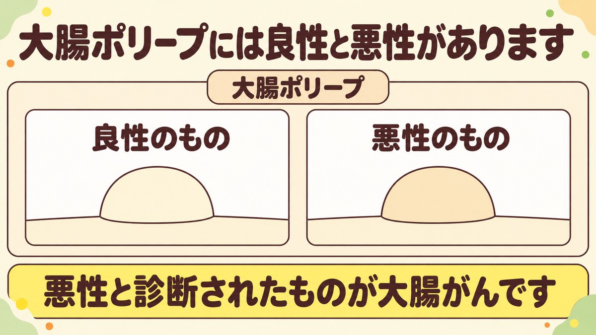 大腸ポリープには良性のものと悪性のものがあり、悪性と診断されたものが大腸がんであることを示す図