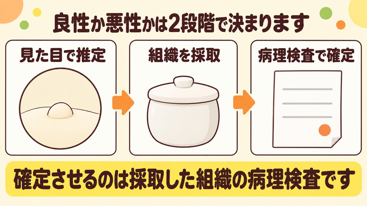 大腸ポリープが良性か悪性かを見た目で推定し、組織を採取して病理検査で確定するまでの2段階を示す図