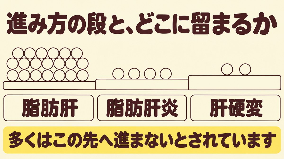 脂肪肝から脂肪肝炎、肝硬変へと進む段を並べ、多くはいちばん手前の段に留まることを示した図