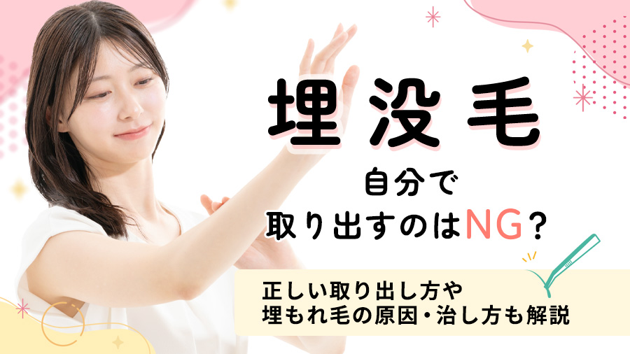 埋没毛を自分で取り出すのはNG？正しい取り出し方や埋もれ毛の原因・治し方も解説