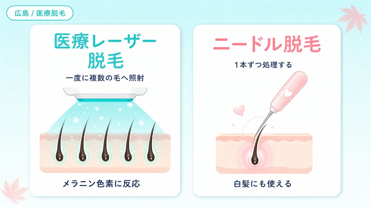 医療レーザー脱毛とニードル脱毛の違い