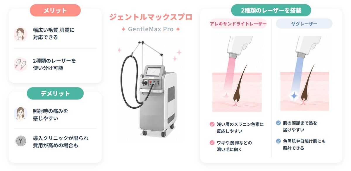 ジェントルマックスプロの特徴と2種類のレーザー