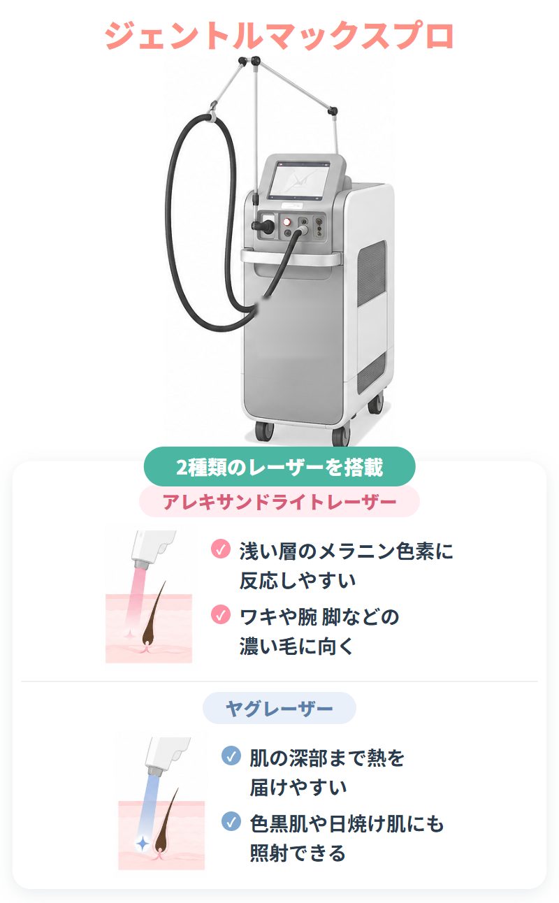 ジェントルマックスプロの特徴と2種類のレーザー