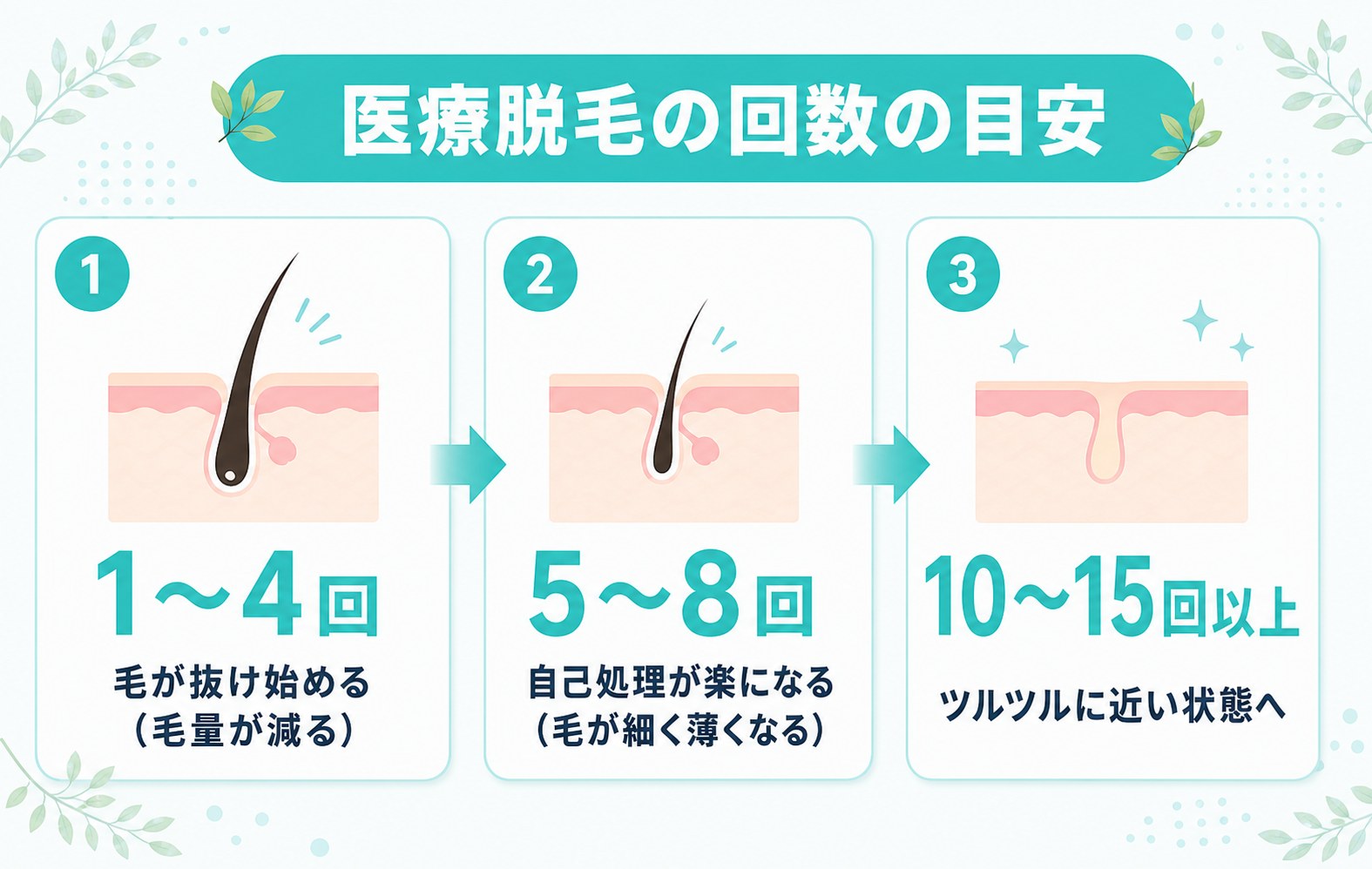 医療脱毛の回数の目安の図解 1〜4回で毛が抜け始め 5〜8回で自己処理が楽になり 10〜15回以上でツルツルに近い状態へ