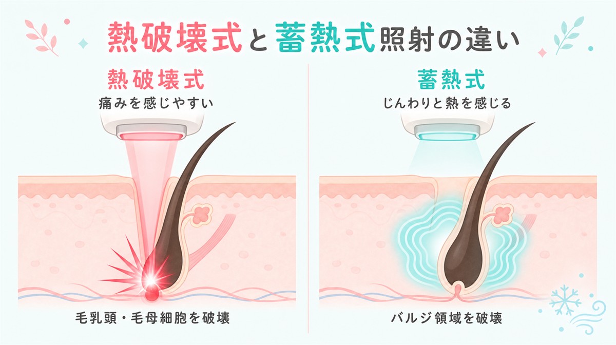 熱破壊式と蓄熱式照射の違い