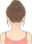 硬毛化・増毛化
