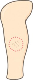 打ち漏れ