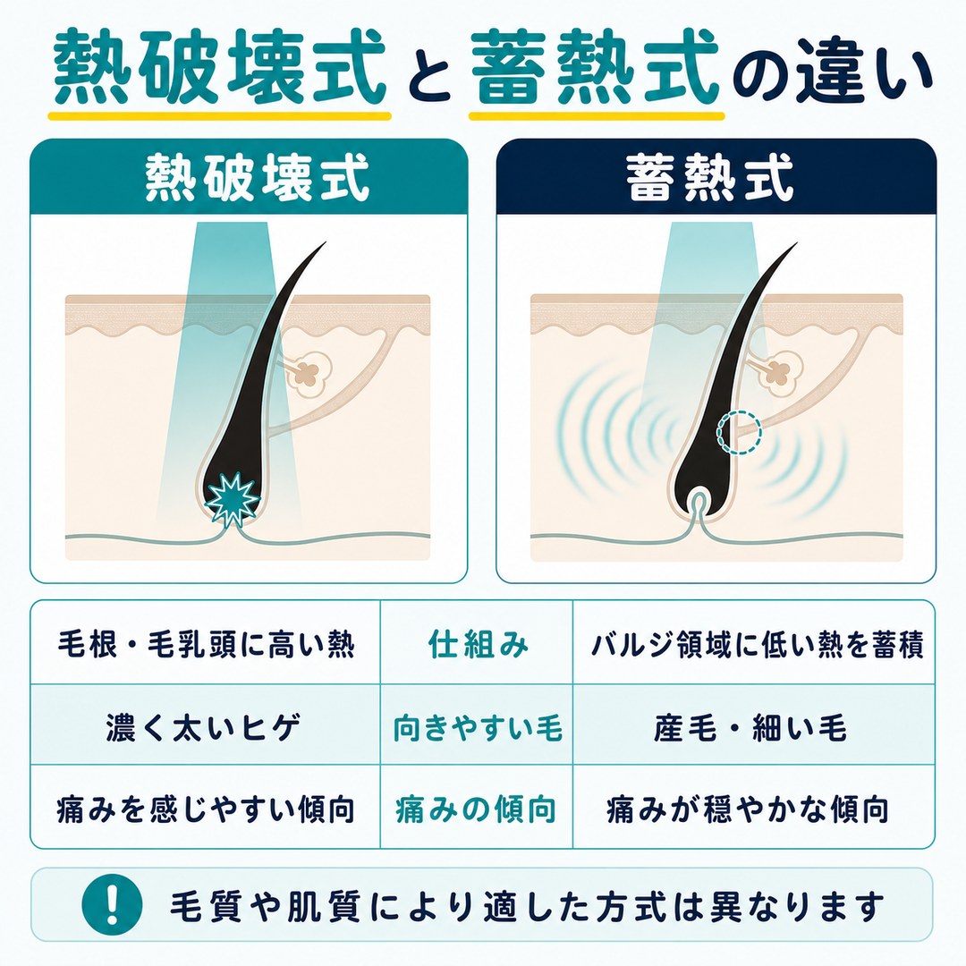 医療脱毛機の熱破壊式と蓄熱式の違いの比較表