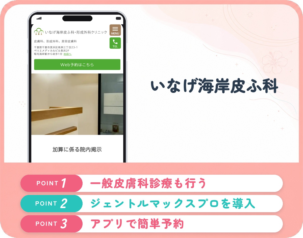 いなげ海岸皮ふ科・形成外科クリニックの医療脱毛特徴まとめバナー
