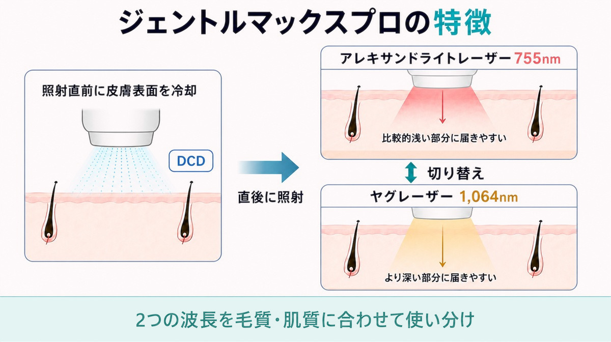 ジェントルマックスプロの2波長とDCDの特徴