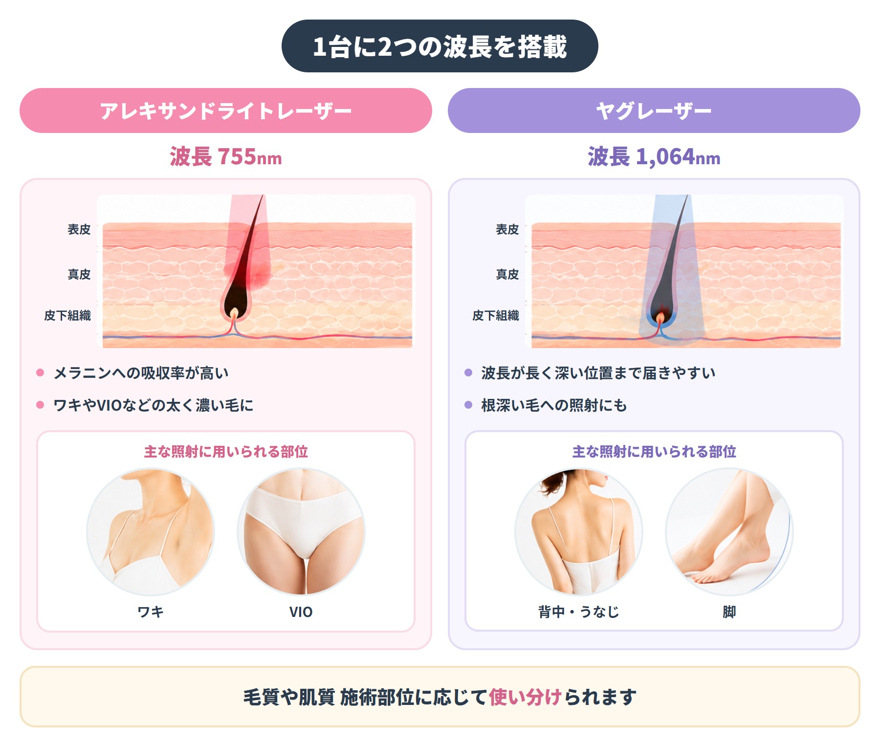 京都でジェントルマックスプロ・プラス導入の医療脱毛クリニックは？