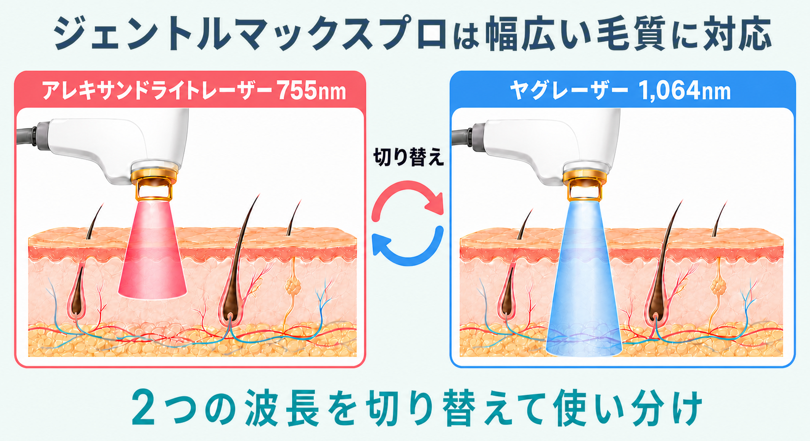 ジェントルマックスプロの2つの波長を切り替えて使い分ける仕組み