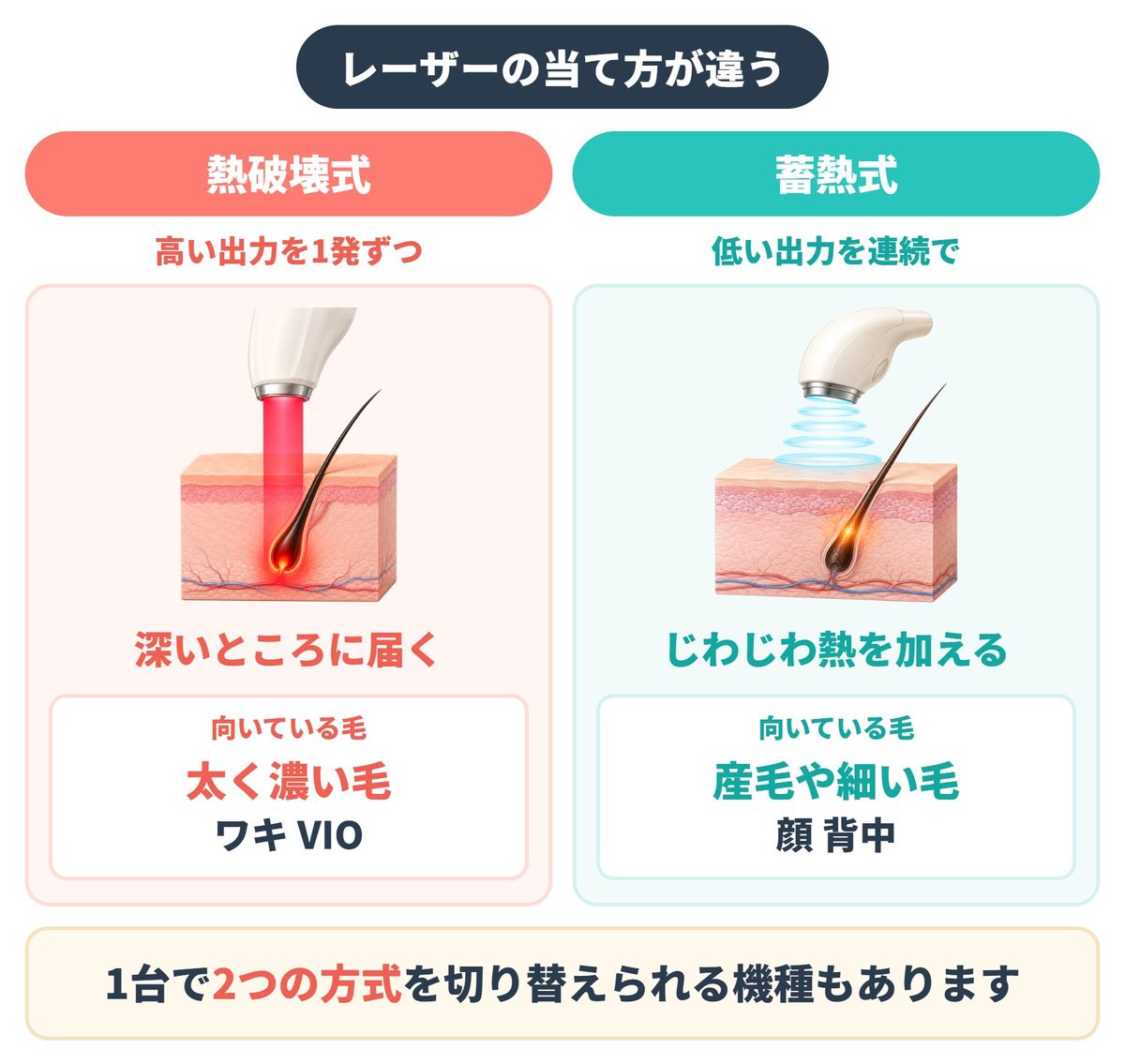 札幌でヤグレーザー搭載のジェントルマックスプロがある医療脱毛クリニック