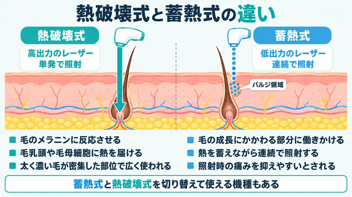 熱破壊式と蓄熱式の違い|高出力のレーザーを単発照射する方式と低出力のレーザーを連続照射する方式の比較図