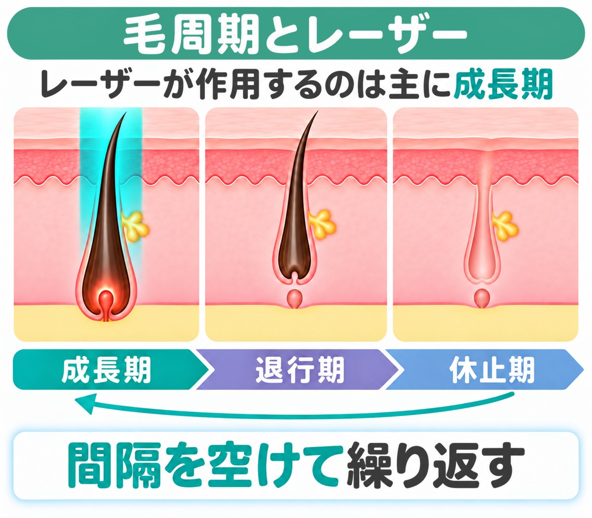 毛周期とレーザー|レーザーは主に成長期の毛に作用するため間隔を空けて繰り返す
