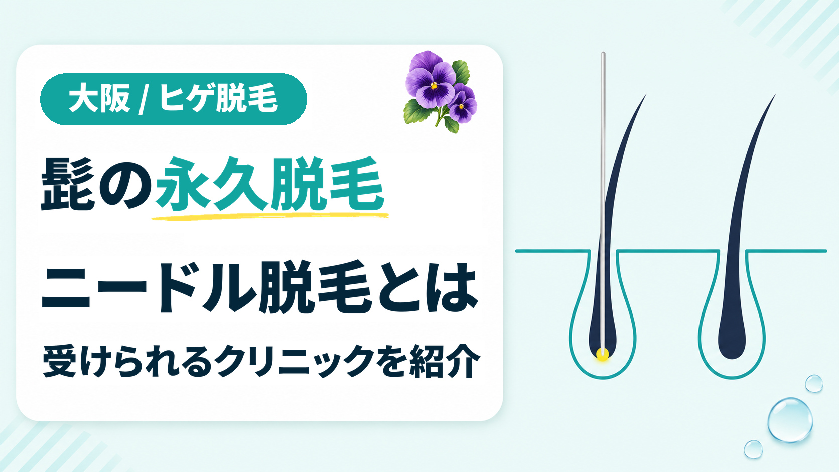 大阪で髭の永久脱毛を目指せるニードル脱毛が受けられるクリニック