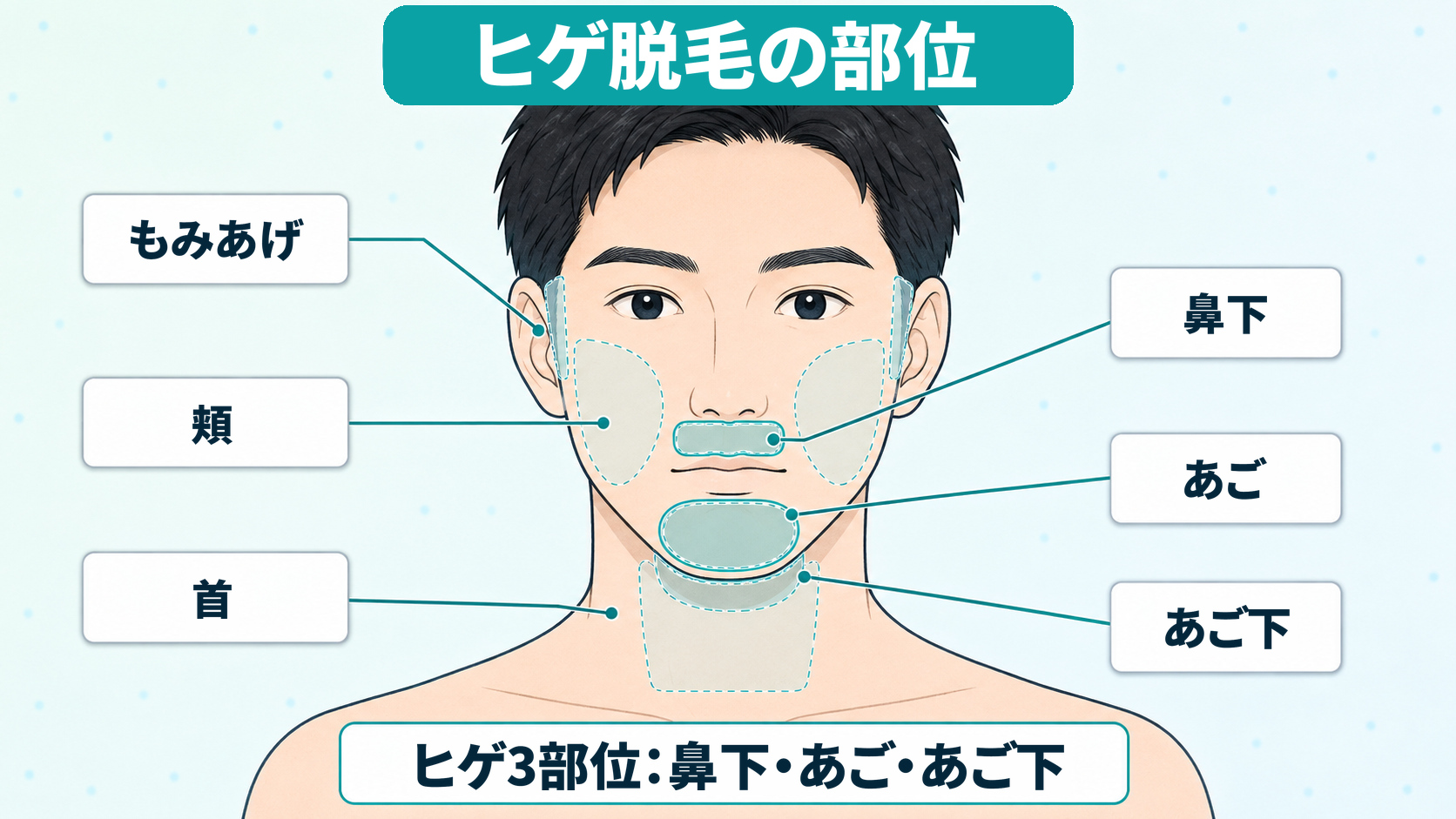 ヒゲ3部位とヒゲ全体に含まれる部位を示した図