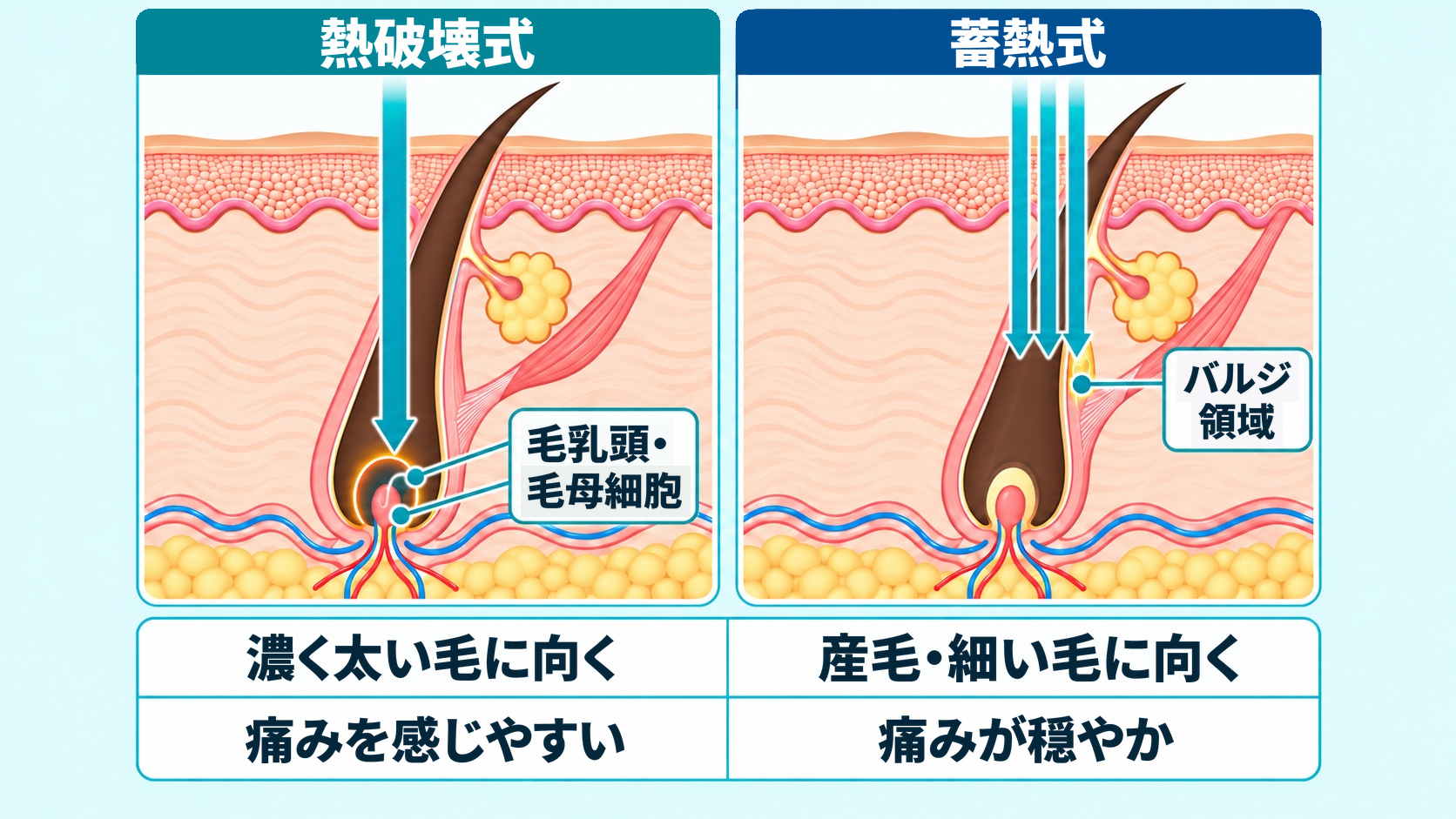 熱破壊式と蓄熱式で熱を当てる場所と当て方の違いを示した図