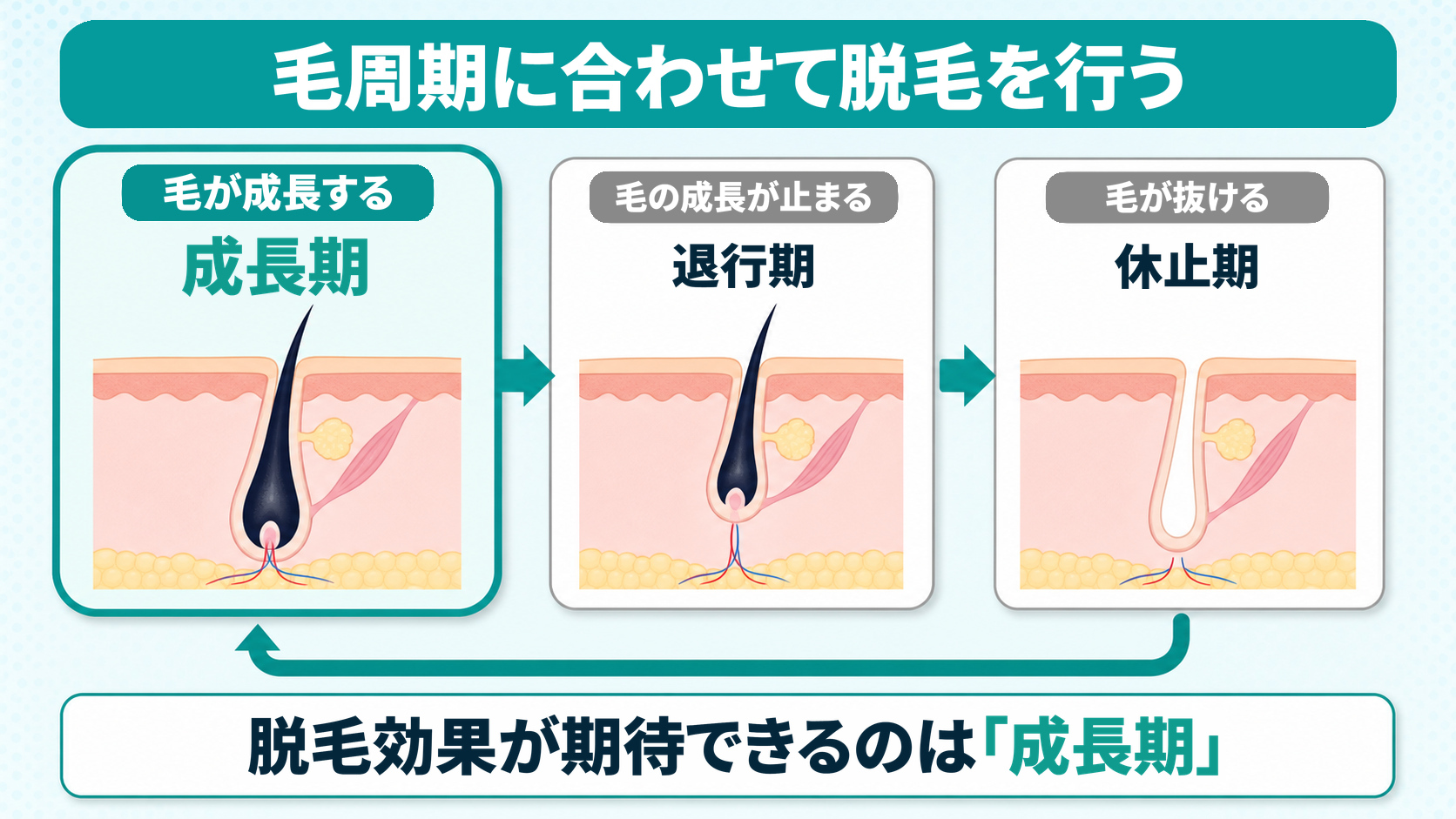 毛周期の成長期・退行期・休止期と照射のタイミングを示した図