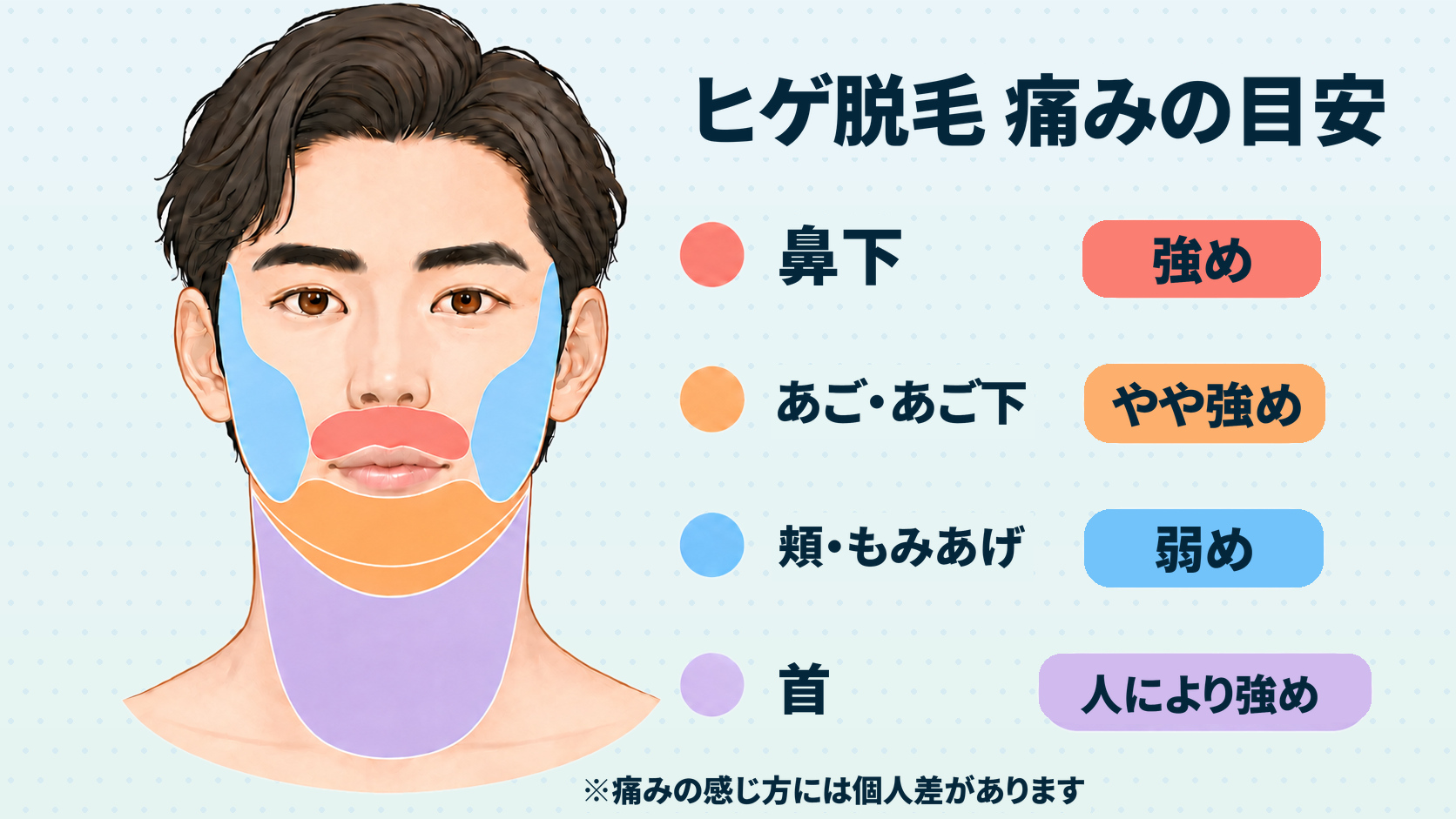 ヒゲ脱毛で痛みを感じやすい部位の目安を示した図