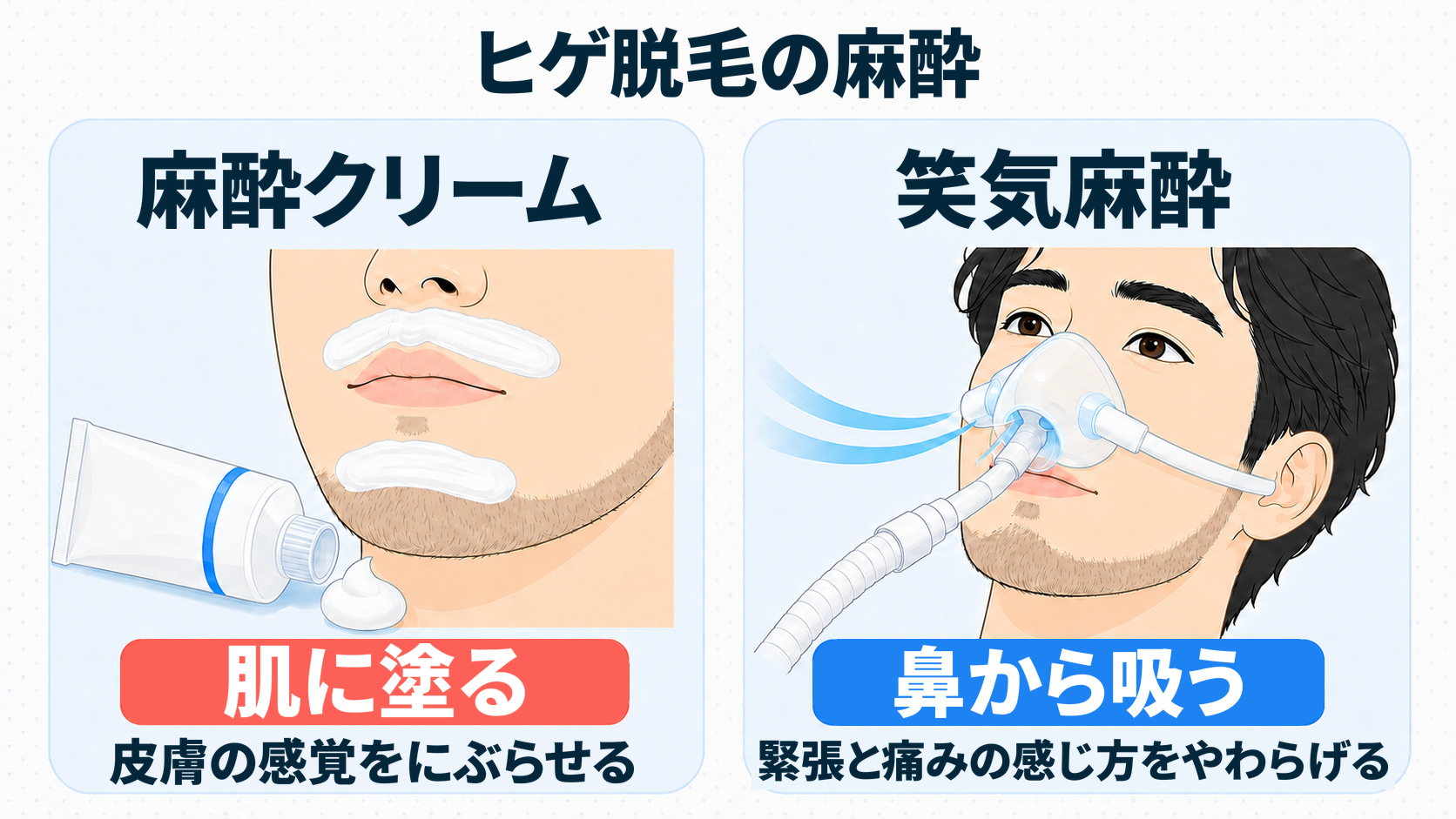 麻酔クリームと笑気麻酔の使い方の違いを示した図