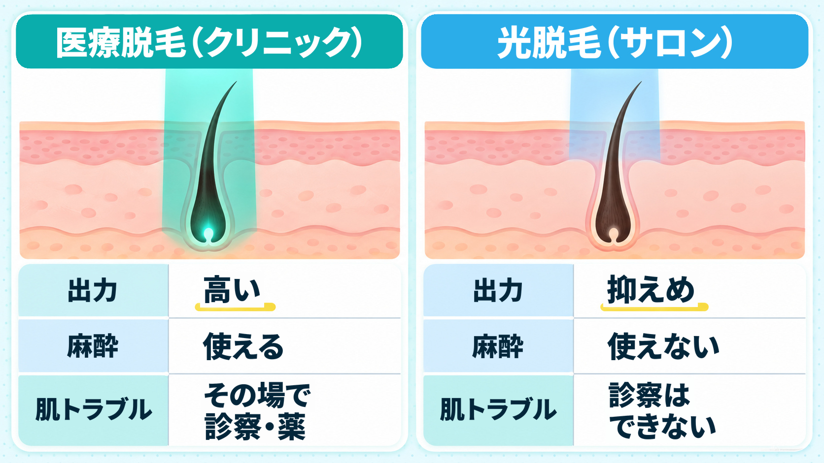 医療脱毛と脱毛サロンの光脱毛の違いを比べた図