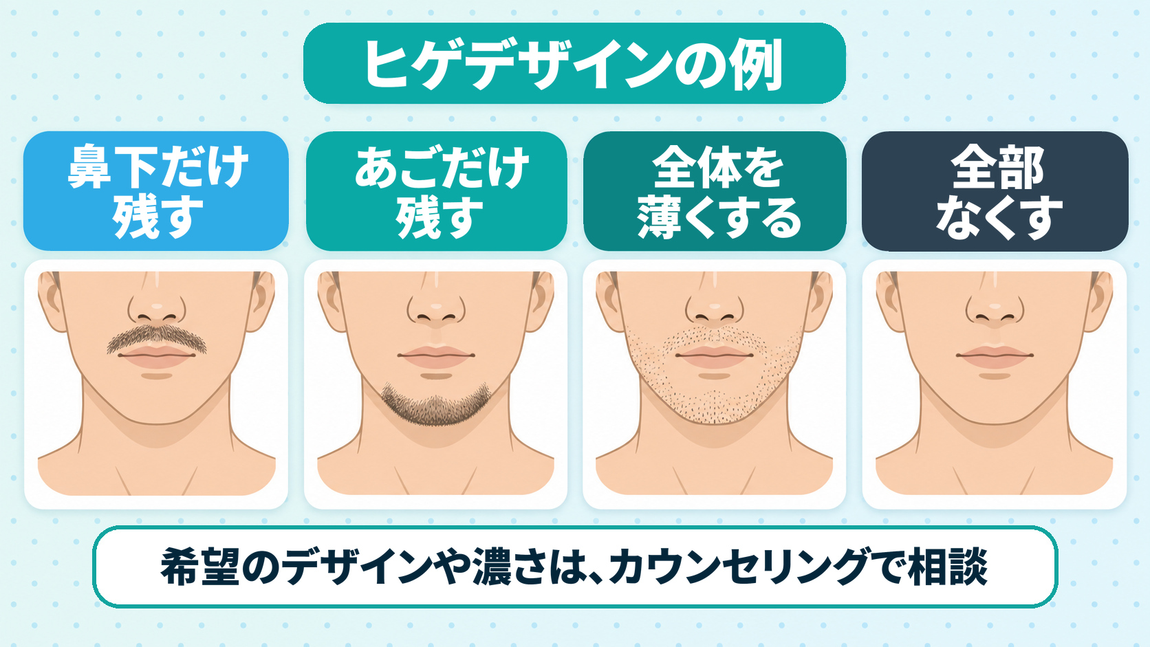 ヒゲデザインの例（鼻下だけ残す・あごだけ残す・全体を薄くする・全部なくす）を示した図