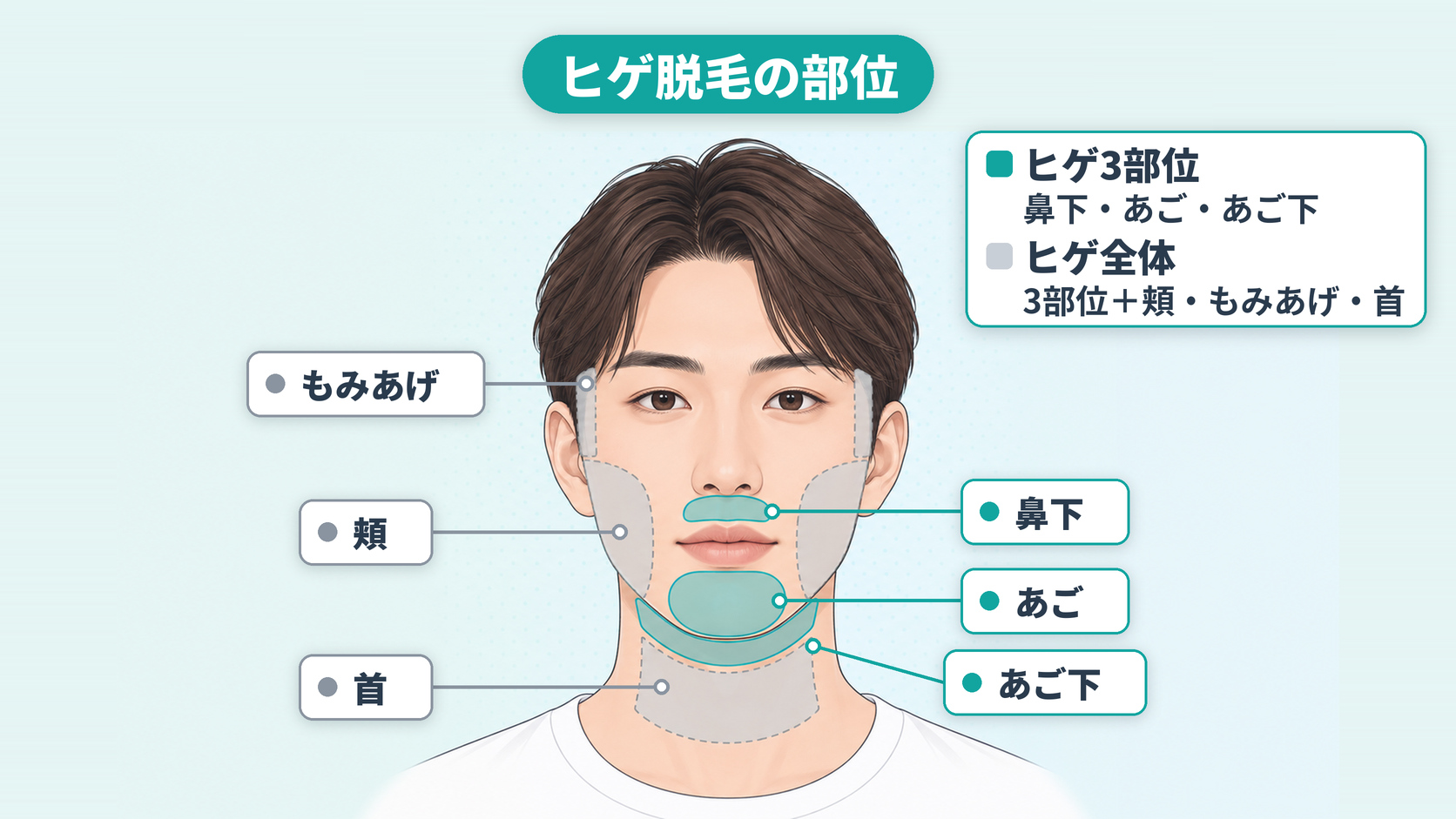 ヒゲ3部位とヒゲ全体に含まれる部位を示した図
