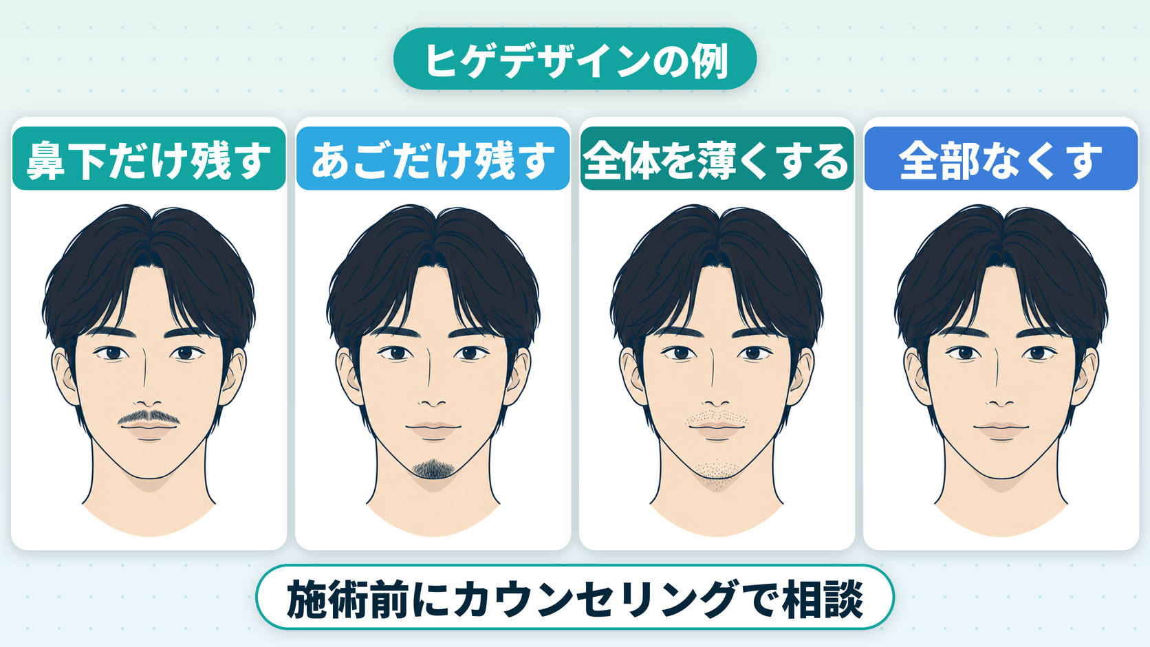 ヒゲデザインの例（鼻下だけ残す・あごだけ残す・全体を薄くする・全部なくす）を示した図