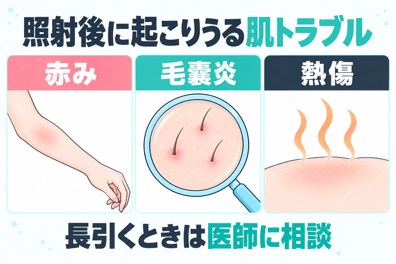 鹿児島の医療脱毛の照射後には赤みや毛嚢炎や熱傷などの皮膚トラブルが起こる可能性があり長引くときは施術を受けたクリニックの医師に相談することを示す図