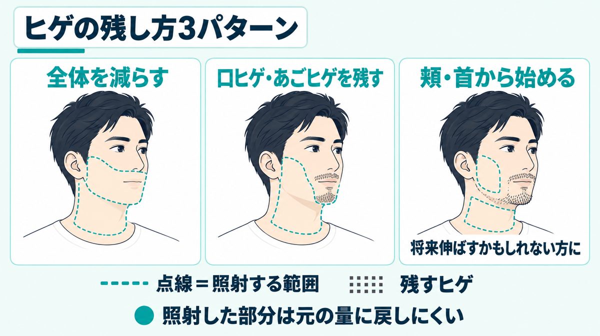 ヒゲの残し方3パターン