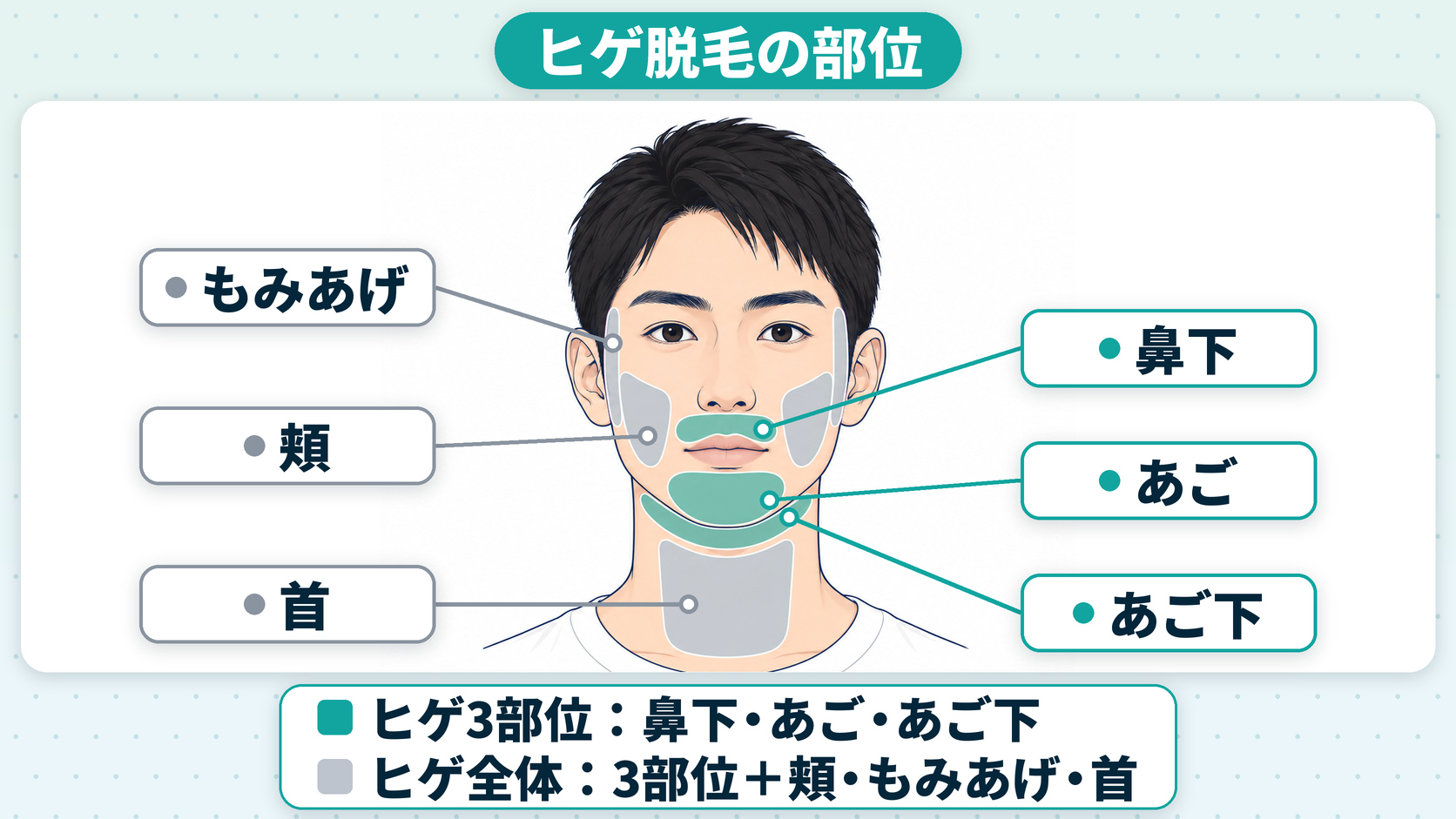 ヒゲ脱毛の部位（もみあげ・鼻下・頬・あご・あご下・首）とヒゲ3部位の解説図