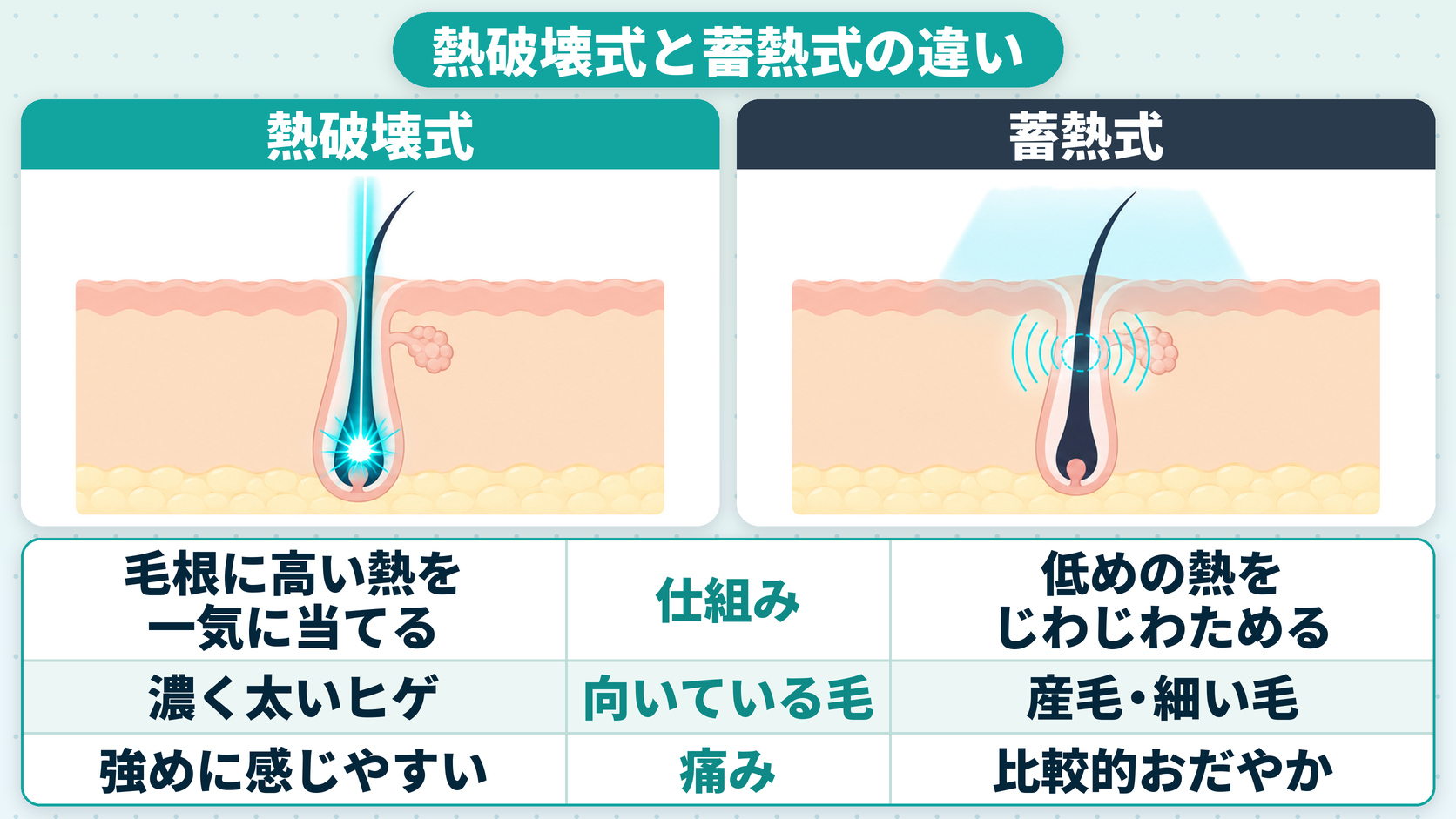 医療脱毛機の熱破壊式と蓄熱式の違いの比較表