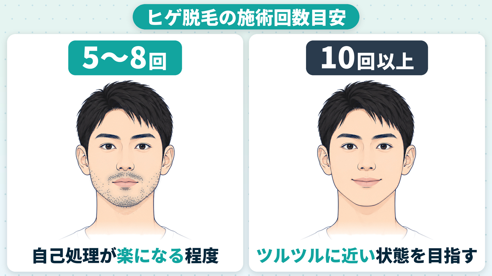 ヒゲ脱毛の施術回数目安（5〜8回で自己処理が楽になる程度・10回以上でツルツルに近い状態）の解説図