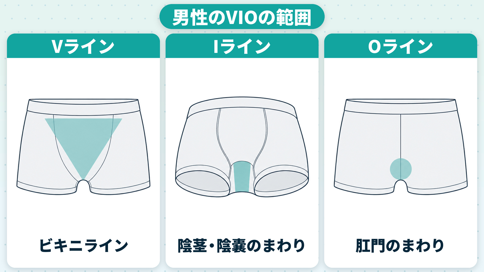 男性のVIOの範囲（Vライン＝ビキニライン・Iライン＝陰茎と陰嚢のまわり・Oライン＝肛門のまわり）