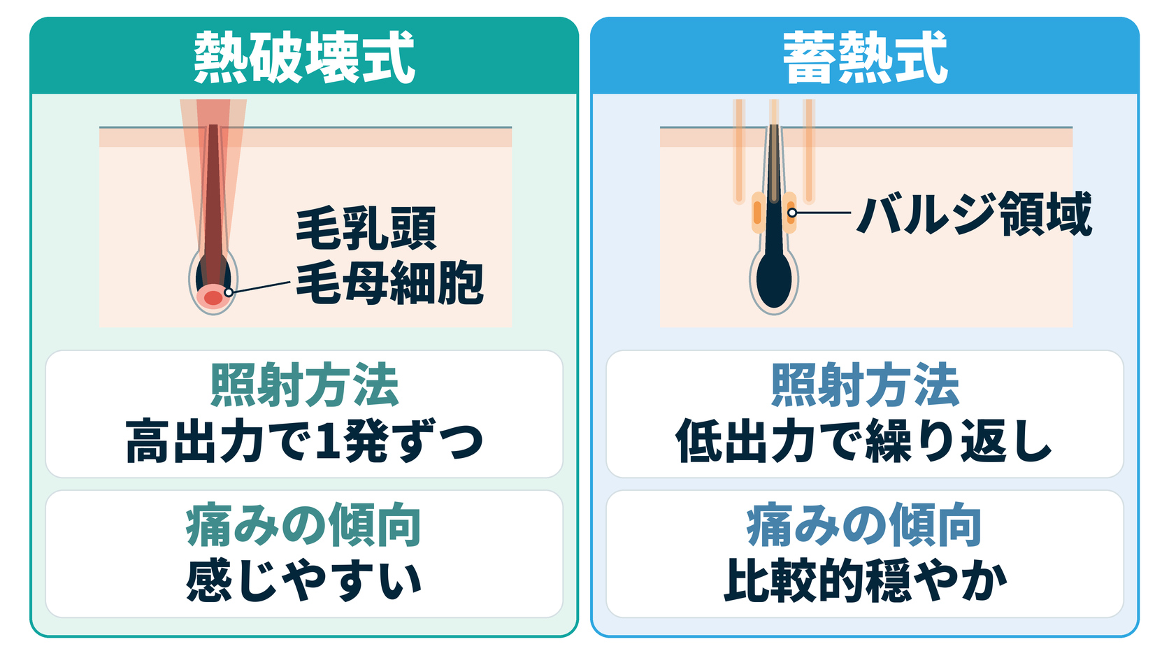 熱破壊式と蓄熱式のちがい（熱破壊式は毛乳頭・毛母細胞に高出力で1発ずつ照射し、痛みを感じやすい。蓄熱式はバルジ領域に低出力で繰り返し照射し、痛みは比較的穏やか）