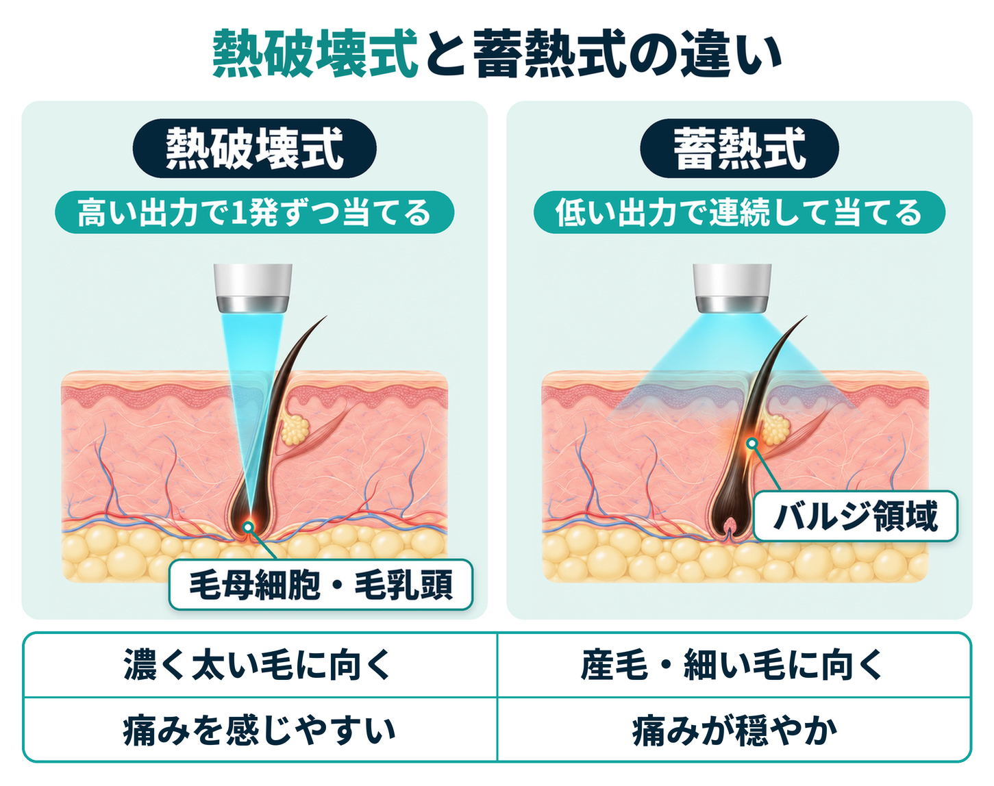 熱破壊式と蓄熱式の違い(当て方・熱を当てる場所・向く毛・痛み)を示した図
