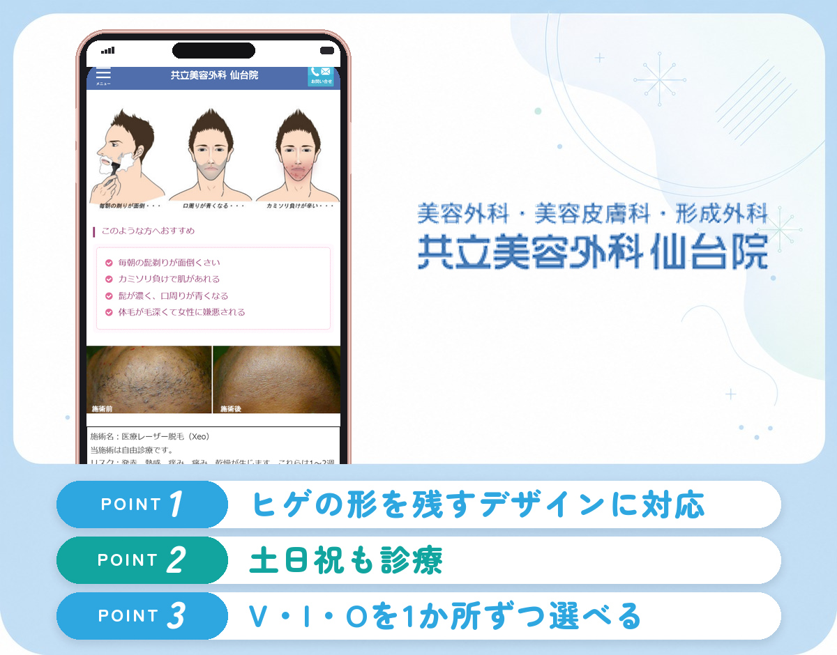 共立美容外科仙台院のヒゲ脱毛の特徴まとめバナー