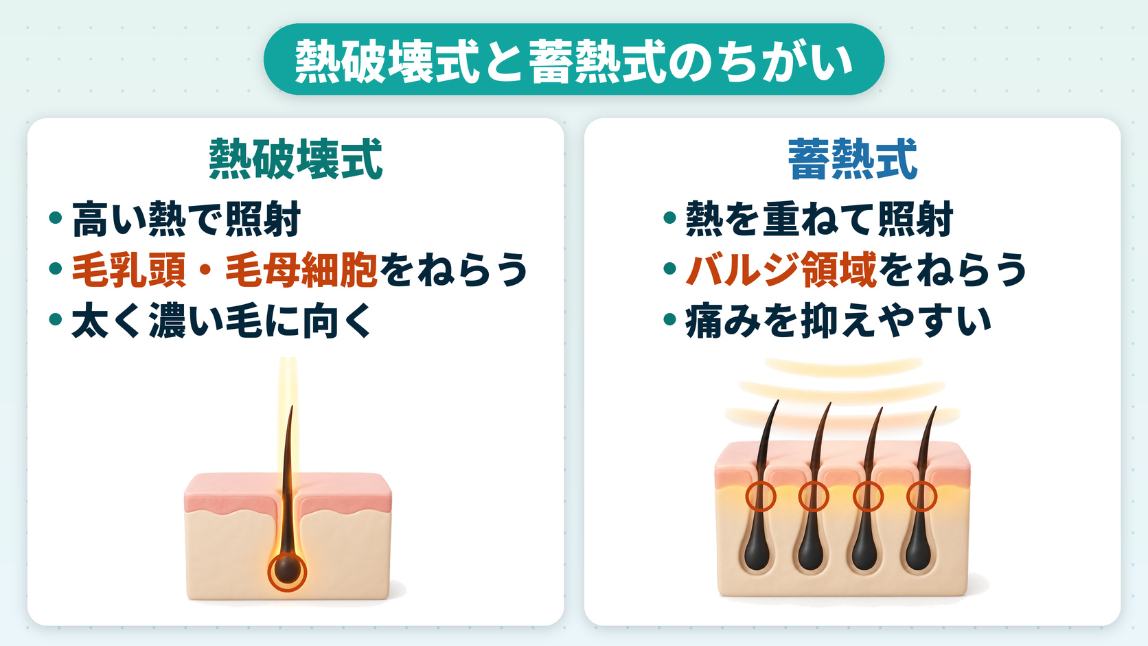 熱破壊式と蓄熱式のちがい（熱破壊式は毛乳頭・毛母細胞に高い熱で照射／蓄熱式はバルジ領域に熱を重ねて照射）
