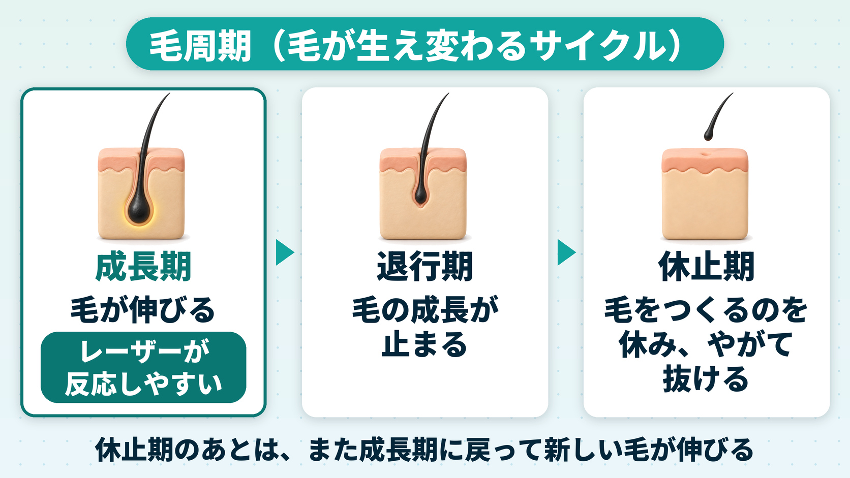 毛周期（毛が生え変わるサイクル）：成長期・退行期・休止期をくり返し、レーザーは成長期の毛に反応しやすい