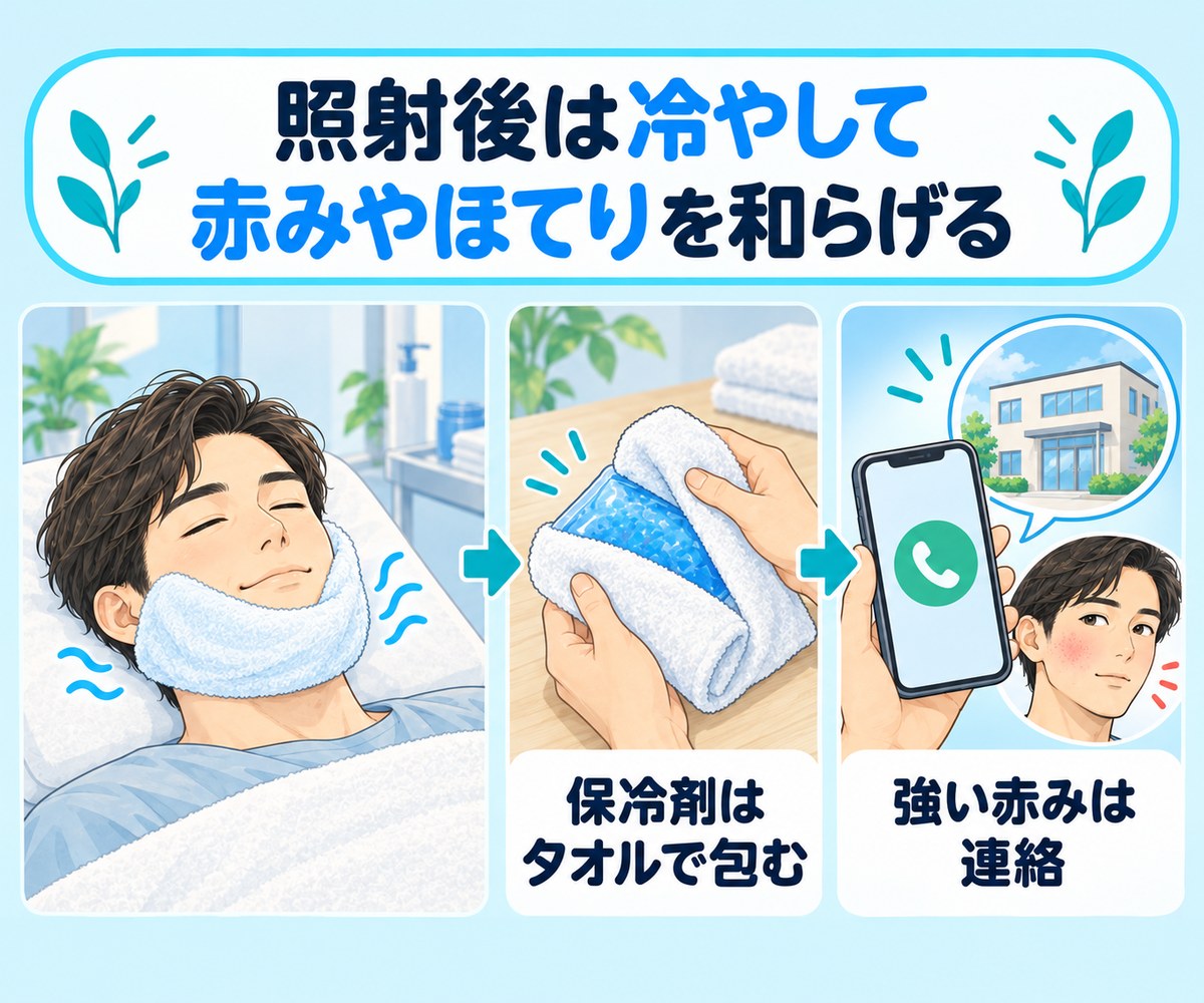 照射後に冷たいタオルで肌を冷やし、保冷剤はタオルで包み、強い赤みはクリニックに連絡するイラスト