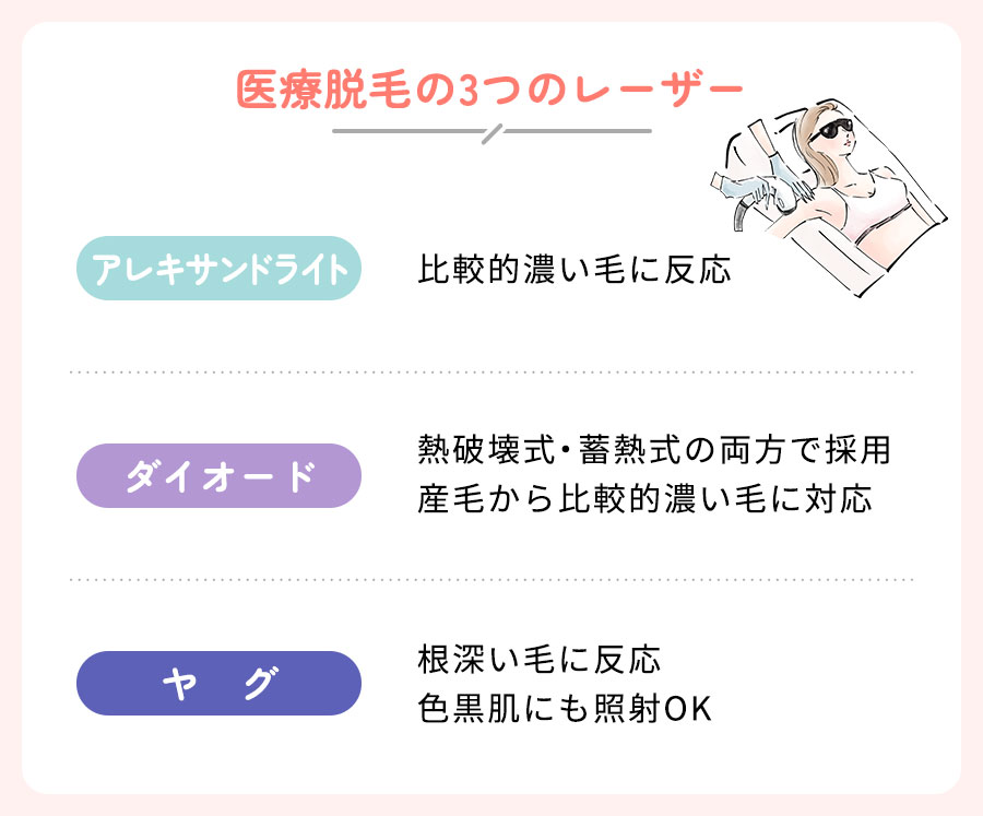 医療脱毛機の3つのレーザー特徴まとめ