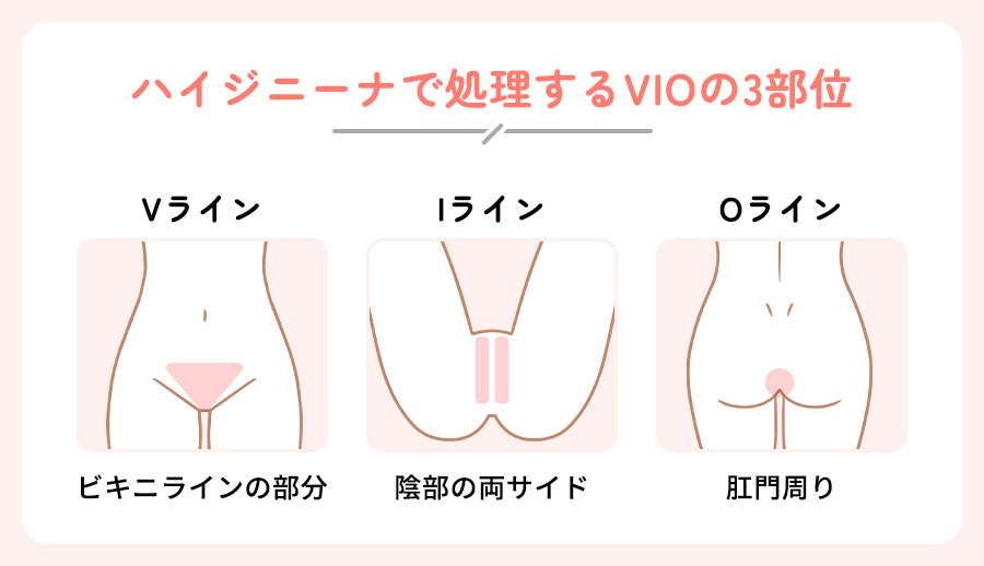 VIOの３部位の図説